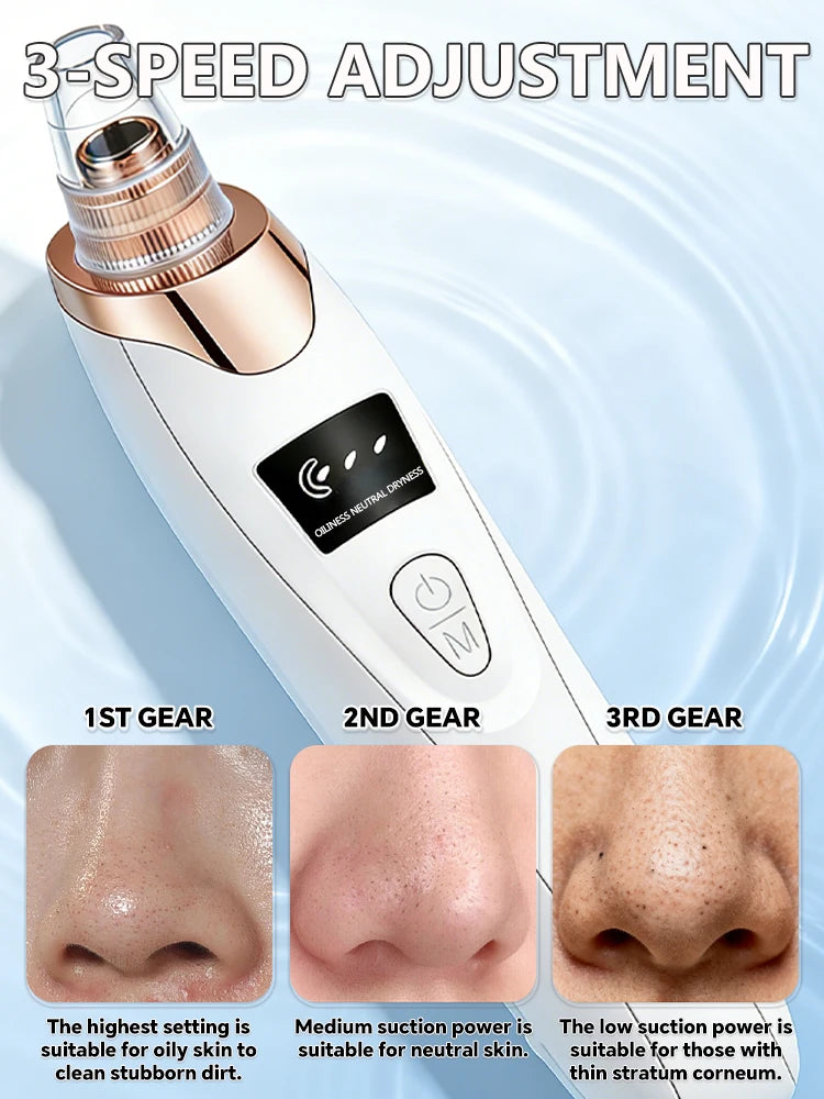 5in1 Rechargeable Blackhead Remover and Vacuum Suction Acne Pore Cleaner Essencify