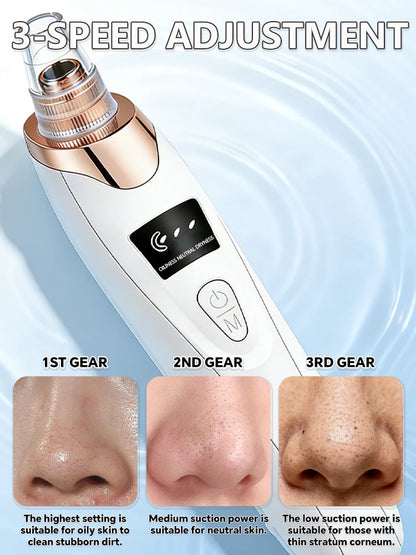 5in1 Rechargeable Blackhead Remover and Vacuum Suction Acne Pore Cleaner Essencify