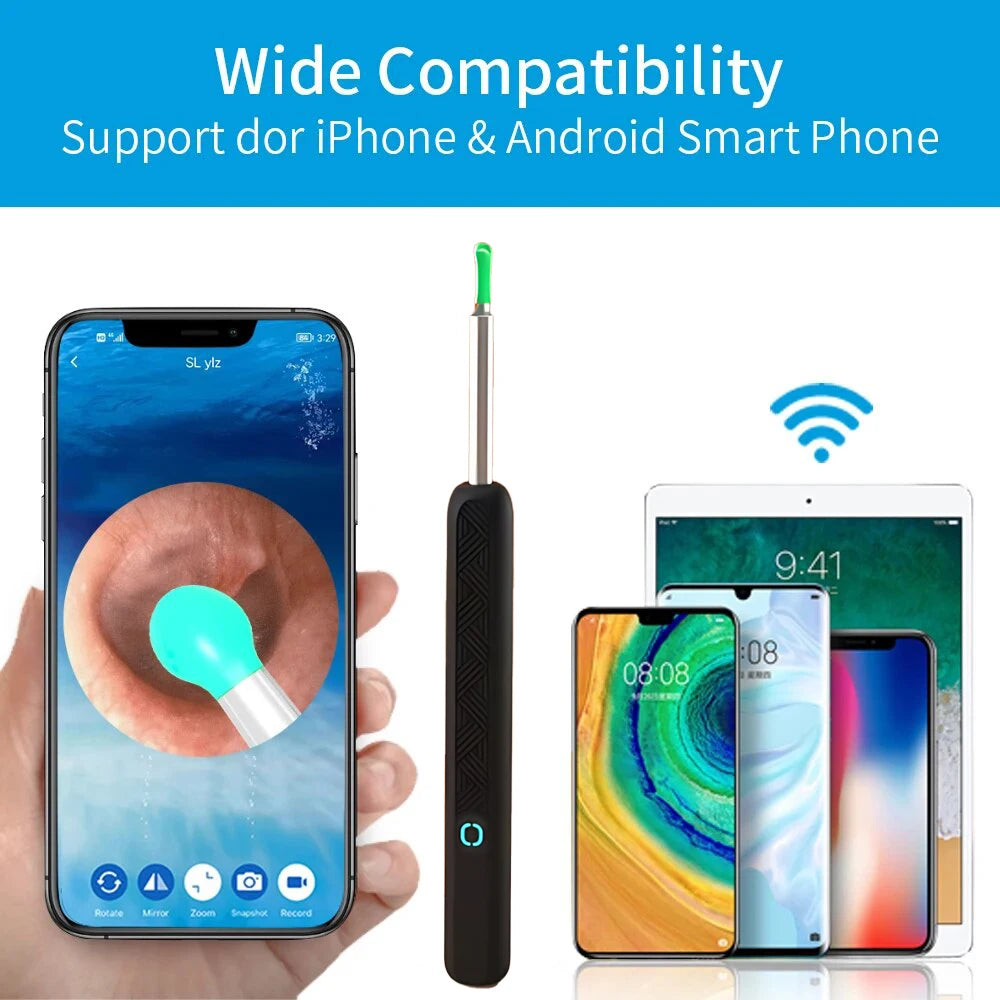 Smart Visual Ear Cleaner with Camera - 1080P HD Otoscope Wax Remover Essencify