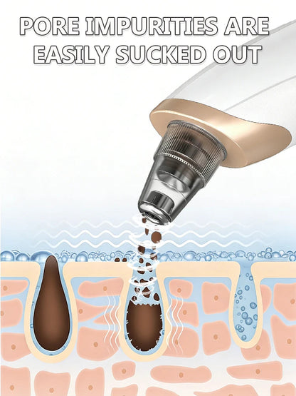 5in1 Rechargeable Blackhead Remover and Vacuum Suction Acne Pore Cleaner Essencify
