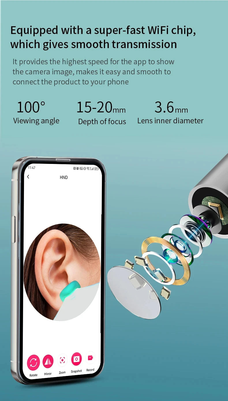 Smart Visual Ear Cleaner with Camera - 1080P HD Otoscope Wax Remover Essencify